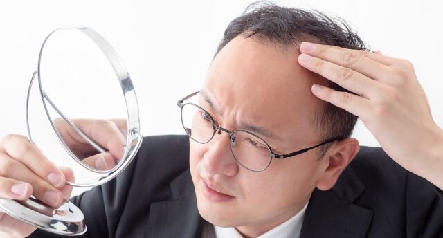 ハゲや薄毛でも結婚できる？薄毛が婚活に与える影響と成功するための対策！